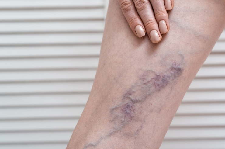 S.V. Multi Speciality Hospital